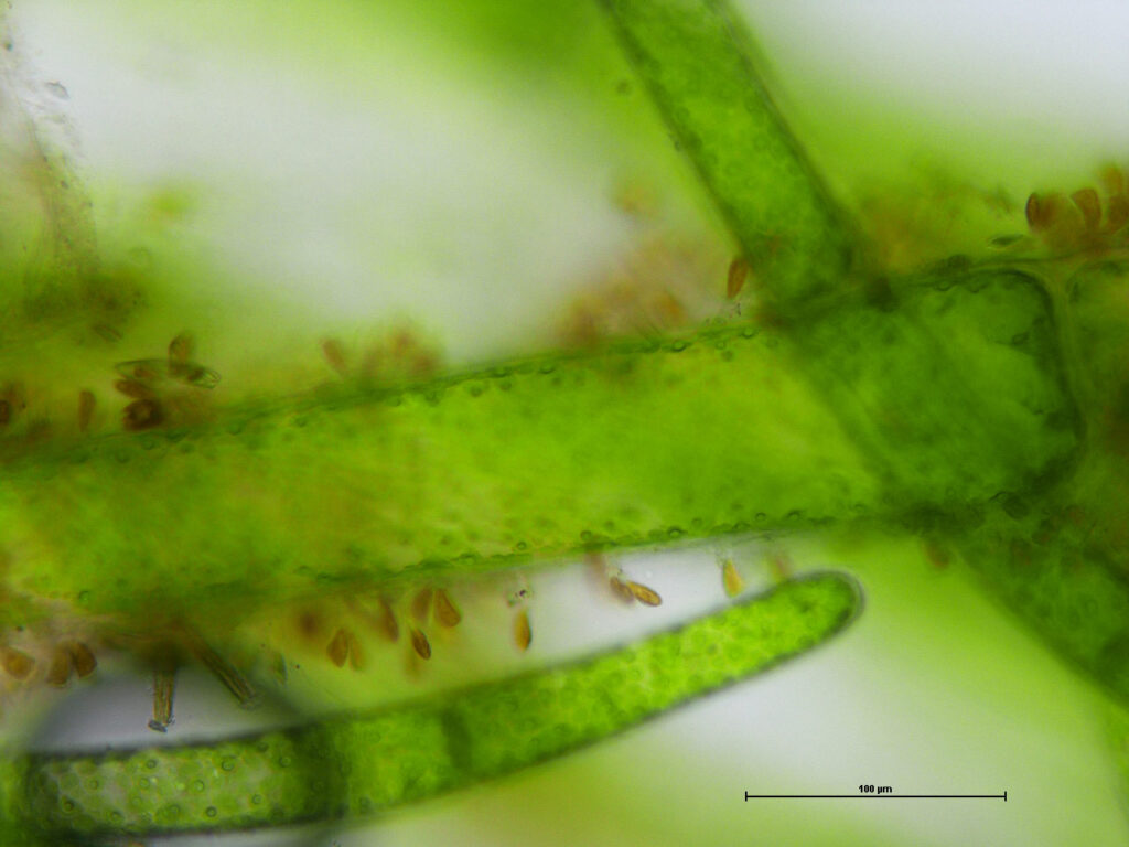 immagine per Cellula 20X con diatomee