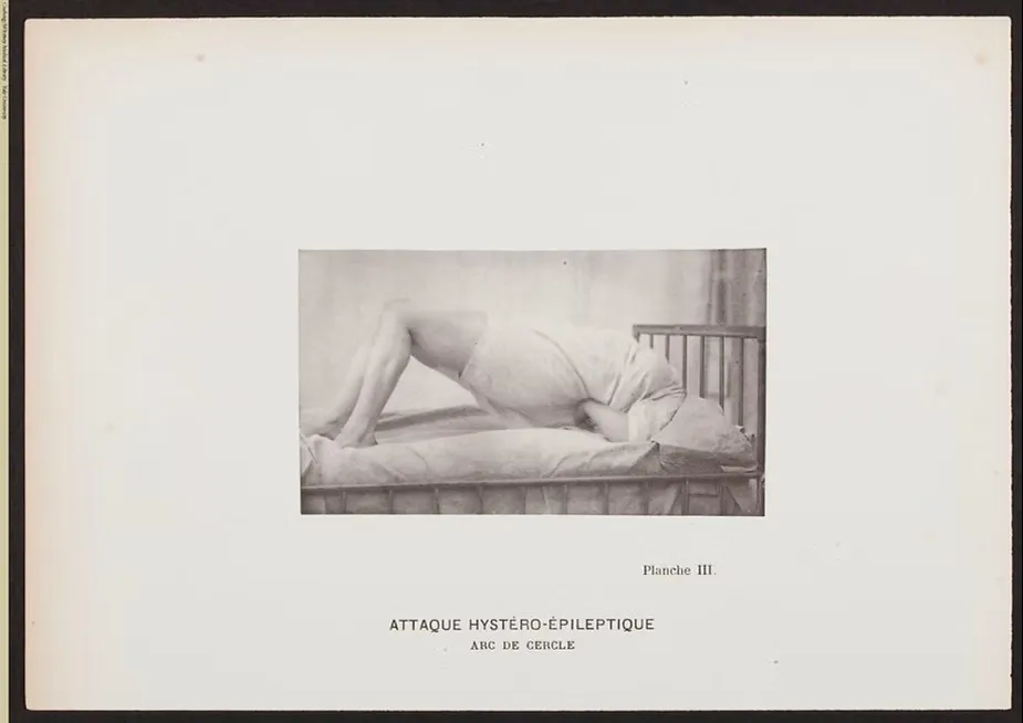 immagine per Paul Régnard Attaque Hystéro épileptique Arc de Cercle 1880